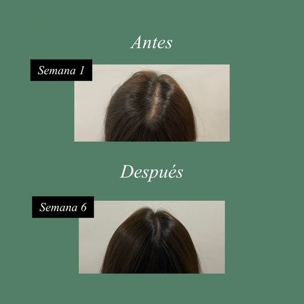 Scalp Renew Hair Loss Treatment 4 OZ